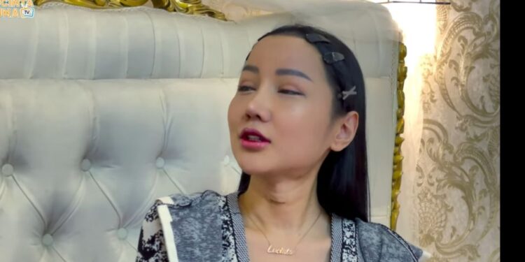 Tunjukkan Wajah Usai Operasi, Reaksi Lucinta Luna Bikin Ngakak saat Disebut Mirip Muhammad Fattah