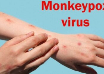 Survei Amerika Serikat Ungkap 99 Persen Kasus Cacar Monyet Menyerang Lelaki