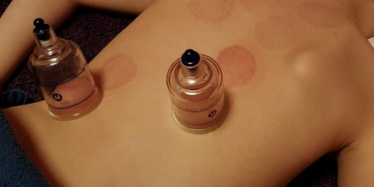 Gagas Wellnes Tourism, Kemenkes Maksimalkan Potensi Wisata Kesehatan di Indonesia